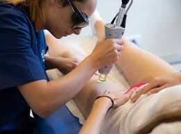 Epilation Laser 5 Raisons D Y Succomber Sans Regrets