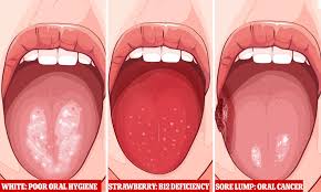 Maybe you would like to learn more about one of these? Sydney Dentist Reveals The Signs To Look Out For Including White Patches Sore Lumps And Swelling Daily Mail Online