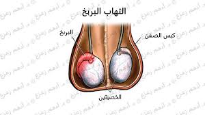 التهاب البربخ الأسباب والأعراض و العلاج gemstone rings gemstones jewelry