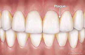 Dr nemeth offers many flossing alternatives. How To Floss Your Teeth Dr George P Cerniglia Metairie Louisiana