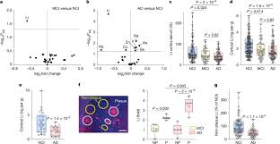 Lithium: Could This Mineral Be the Key to Preventing Alzheimer's? - Imagen principal del artículo