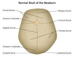 A fairly rigid joint between two or more hard elements, such as the bony plates of the skull. Fusion Of Suture 1 Metopic Suture At 3 Yrs 2 Sagittal Coronal Lambda Suture Begin To Close From Inner Side At Newborn Medical School Essentials Skull