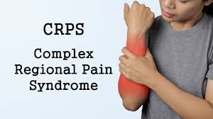 Complex Regional Pain Syndrome Crps Youtube