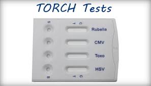 The infection classically occurs in teenagers and young adults, hence its other name. Ù…Ø§ Ù‡ÙŠ ØªØ­Ø§Ù„ÙŠÙ„ ØªÙˆØ±Ø´ Torch Ø§Ù„Ù…Ø±Ø³Ø§Ù„