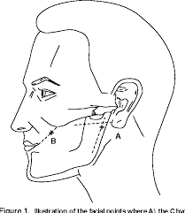 This is due to the nerves in the area being hyperexcited due to the lack of calcium. Signs Of Hypocalcemia Chvostek S And Trousseau S Signs Semantic Scholar