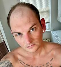 What would I look like with a bald head?