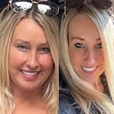 If I'm having periods every 26 days should I use the hormone drops as  normal?