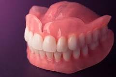 Types of Dentures and cost in Kampala - Dental Clinic in Kampala