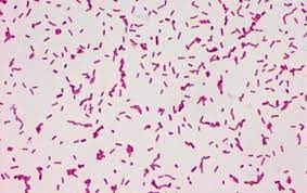 A salmonella sample can be obtained directly from the patient (feces) or from contaminated water/foods. Salmonella Manhattan Salmonella Enterica Subsp Enterica Serovar Manhattan