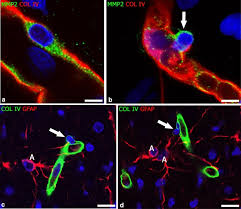 Act kids anticavity fluoride rinse. Neural Crest Cell Derived Pericytes Act As Pro Angiogenic Cells In Human Neocortex Development And Gliomas Springerlink