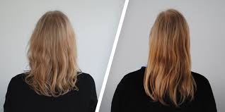 Spezielle foren beschäftigen sich mit haarausfall bei frauen, kreisrundem haarausfall (alopecia areata) und dem. Haartransplantation Erfahrungen Aus Dem Forum Desired De