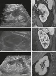 Their nostrils close to keep sand at bay, and they have bushy eyebrows and two rows of long eyelashes to protect their eyes. Common Pitfalls In Renal Mass Evaluation A Practical Guide