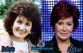 Too Much Plastic Surgery Before And After Worst Celebrity Plastic Surgery Bad Celebrity Plastic Surgery Celebrity Plastic Surgery Plastic Surgery