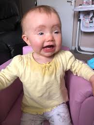 Yes , we all carry the BPES gene !