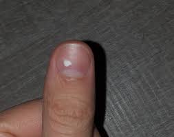 Maybe you would like to learn more about one of these? Leuconiquia Wikipedia La Enciclopedia Libre