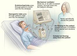 This Illustration Of A Patient On A Ventilator Is One That I Enjoy Quite A Bit I Call The Patient J Nurse Teaching Nursing Information Critical Care Nursing