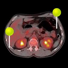 人体の解剖学 Pet Ct