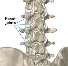 Facet Arthritis Fort Worth Brain And Spine Institute