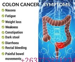 In the early stages of colon cancer, people often have no symptoms. Facebook