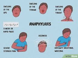 How long does it take to get an allergic reaction. 4 Ways To Recognize An Allergic Reaction Wikihow