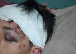 Solano Un Joven Fue Brutalmente Golpeado Por Cuatro Hombres Que Le Robaron Su Celular