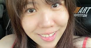 part 02] My IDS Journey with IDS Aesthetics