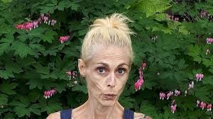 Fundraiser by Maggie Fraser : Feeding Maggie