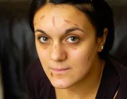 Teen clawed in the face