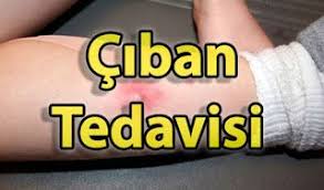 Sagligim Ciban Tedavisi Website Topics Resources