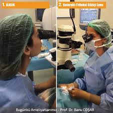 Katarakt Ameliyatinda Goz Icine Konan Mercek Trifokal Uc Odakli Oldugunda Hem Uzak Hem Yakini Gozluksuz Gormek Mumkun Olur If A Gozler Agirliklar Bilgi