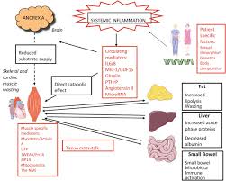 Image result for Cachexia in Cancer