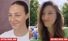 Tall Girl star Ava Michelle, 21, shows off DRAMATIC transformation after  undergoing a NOSE JOB