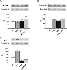 Your thoughts/responses to the question can go in the comments section. Vitamin K2 Supplementation Blocks The Beneficial Effects Of Ifn A 2b Administered On The Early Stages Of Liver Cancer Development In Rats Sciencedirect