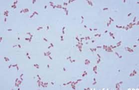 Enterica is the type species and is further divided into six subspecies that include over 2. Solved Can This Negative Gram Stain Be Of Salmonella Typh Chegg Com