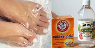 Un Soin De Pied Naturel Pour Traiter Peau Seche Pied D Athlete Et Le Champignon De L Ongle Soin Des Pieds Soin Des Ongles Bain De Pied