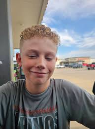 What to use for skin rash