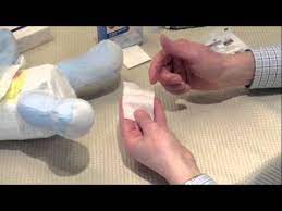 The gauze may stay in place for approximately 24 to 48 hours before falling off on its own. Diamond Circumcision Demonstration Of Life Brand Gauze Application Youtube
