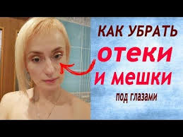 как убрать черные точки на носу в домашних условиях Chem Ya Umenshila Oteki Pod Glazami V Domashnih Usloviyah Ne Kosmetika Nadejda Onbeauty Youtube Pod Glazami Chistoe Lico Lico