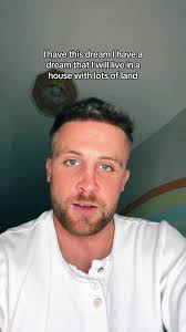 Josh from England Before Hair Replacement