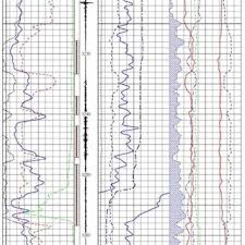 Lithology Independent Fan Chart Using Microsoft Excel