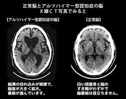【制作陣】 原案・メインシナリオ・キャラクターデザイン：枢やな supported by square enix 開発. èªçŸ¥ç—‡ã¨ã¯ èªçŸ¥ç—‡äºˆé˜²è²¡å›£