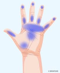 7 Important Things Your Hands Are Trying To Tell You About Your Health Told You So Carpal Tunnel Holistic Treatment