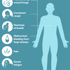 You can manage your pain and discomfort to make it easier on. What To Expect During End Stage Lung Cancer
