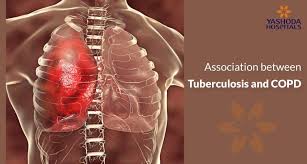 Furthermore, lung cancer symptoms, such as a persistent cough, back pain or weight loss, can resemble a cold or bronchitis and may not raise suspicions of lung cancer. Does Tuberculosis Cause Copd Pulmonary Fibrosis Or Restrictive Lung Disease