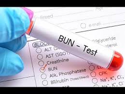 Pin On Triglyceride Test Procedure Lipid Profil Test
