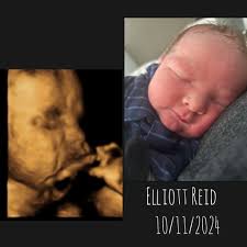 Living Images 3d/4d Ultrasound Studio