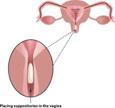 The applicator has three parts: Vaginal Suppositories How To Open Insert Coast To Coast Compounding