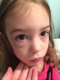 Possible causes of a child's eye appearing abnormal