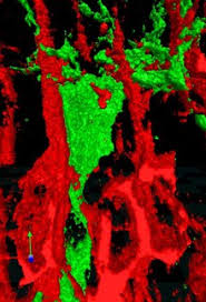 Cells, muller glia, muller cells (en); Muller Glia Wikipedia