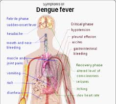 Now it's 100 percent both. Schematic Description Of The Symptoms Of Dengue Fever Www Cdc Com Download Scientific Diagram